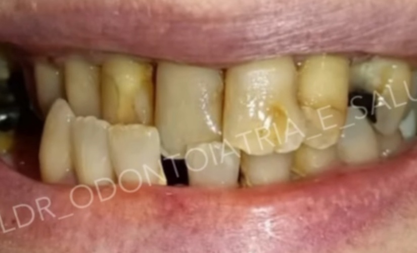 Situazione iniziale del sorriso