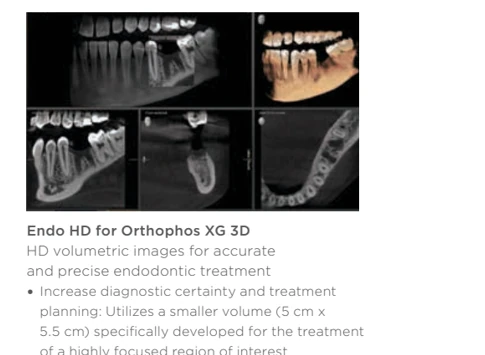 Immagini Endo HD per l’analisi endodontica mirata