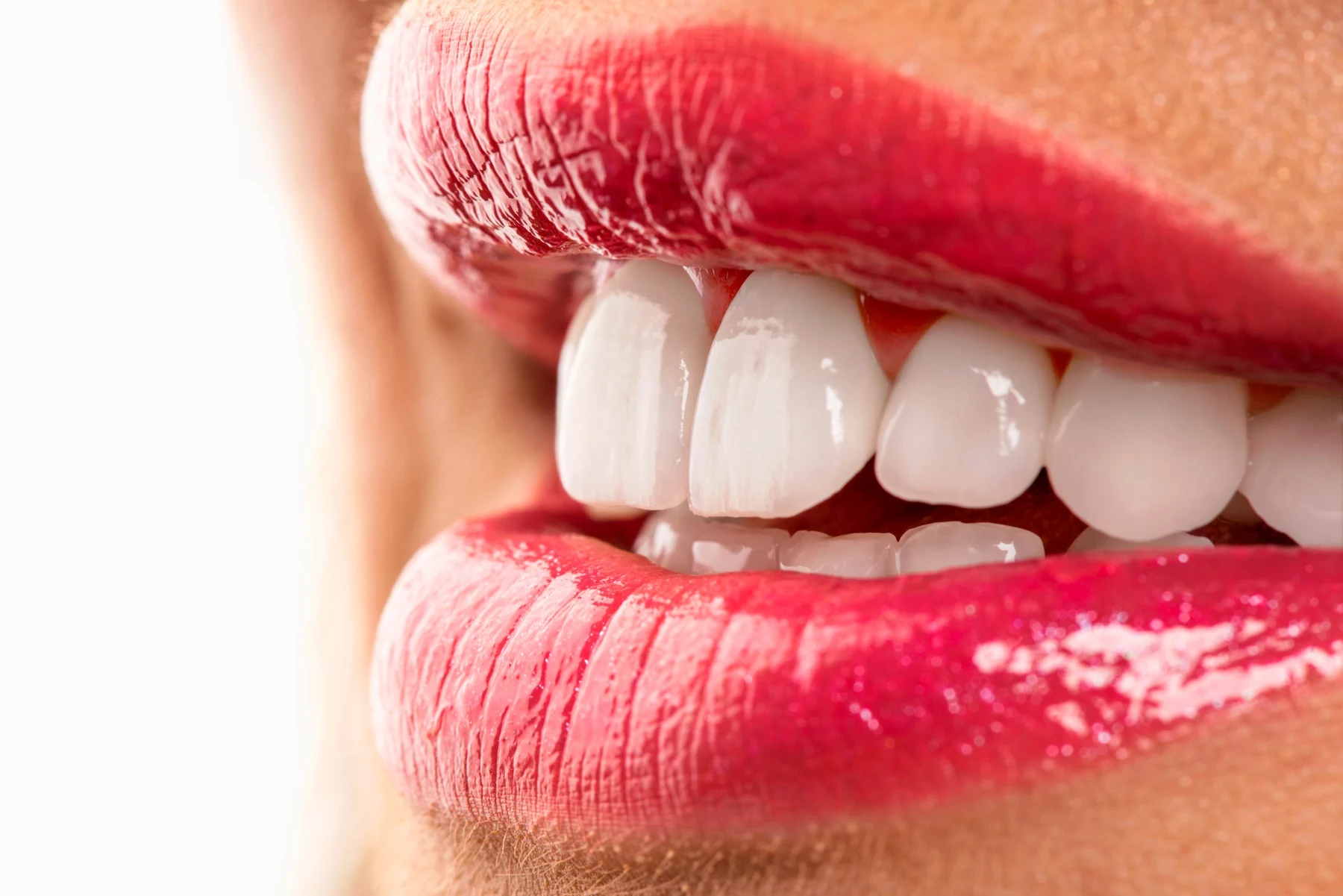 Approfondimento: Odontoiatria estetica