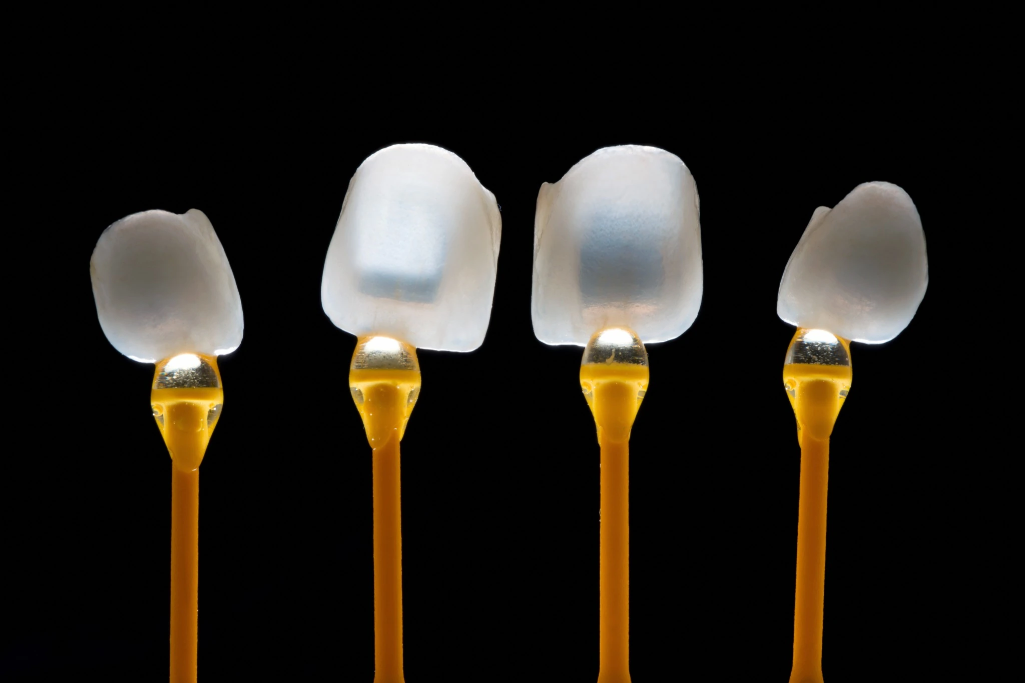 Approfondimento: Faccette dentali